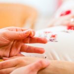 Pregnancy and Acupuncture