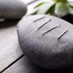 Things to keep in mind before your acupuncture appointment