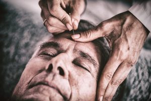 Acupuncture for Seniors
